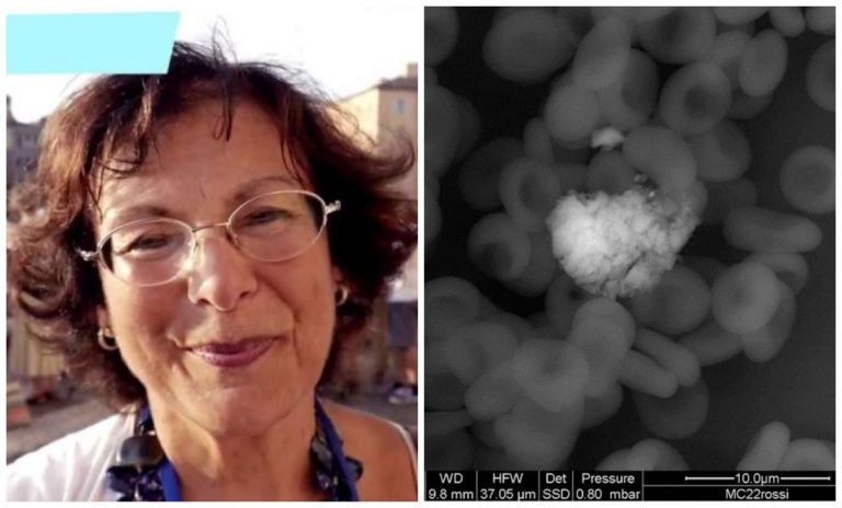 Antonietta Gatti, le epatiti nei bambini e Fedez: intervista alla nanopatologa